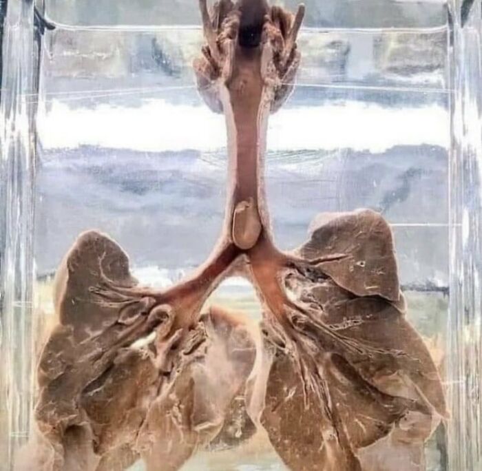 35 Morbid Facts That Might Teach You Something New Or Ruin Your Day