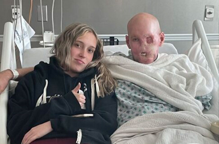 &ldquo;I Don&rsquo;t Want To Wear A Mask&rdquo;: Veteran Who Lost Half Of His Face Receives Eyeball Transplant