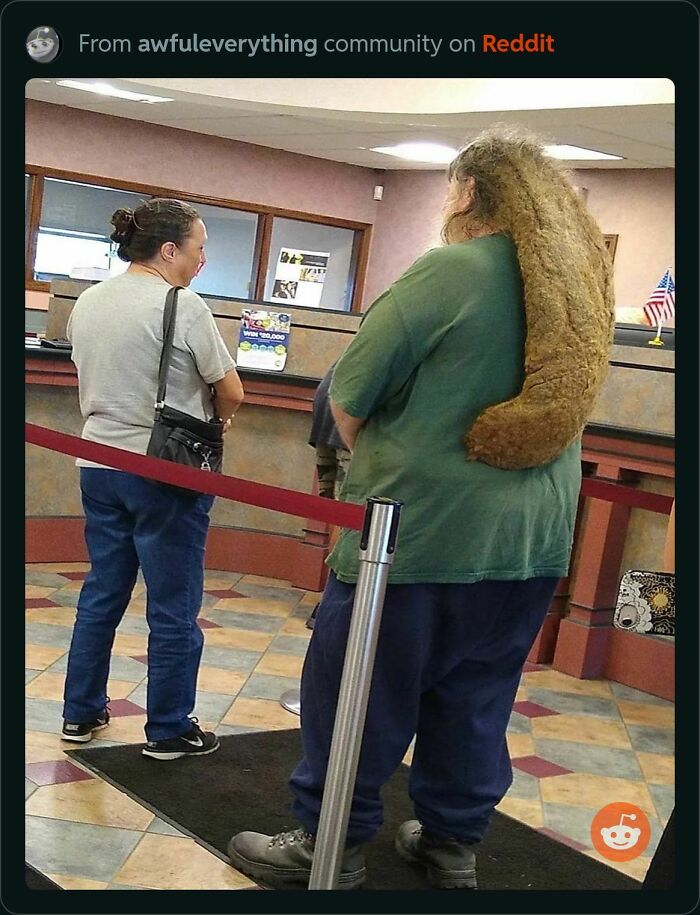 It Looks Like Something Is Hatching Out Of His Head