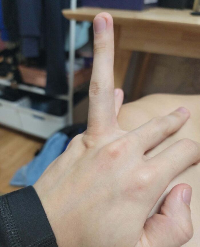 I Can Lift My Ring Finger