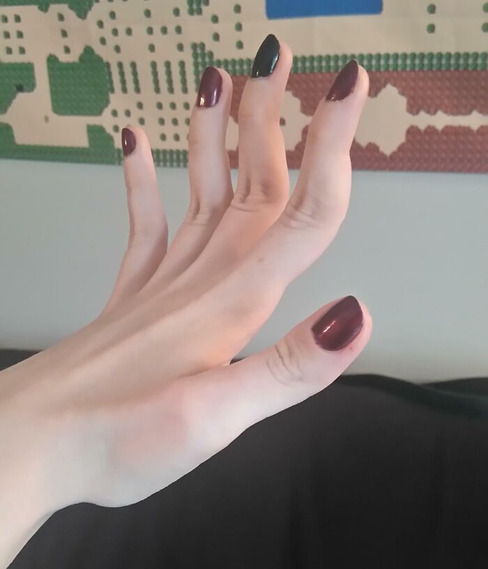 A Little Bit Double-Jointed