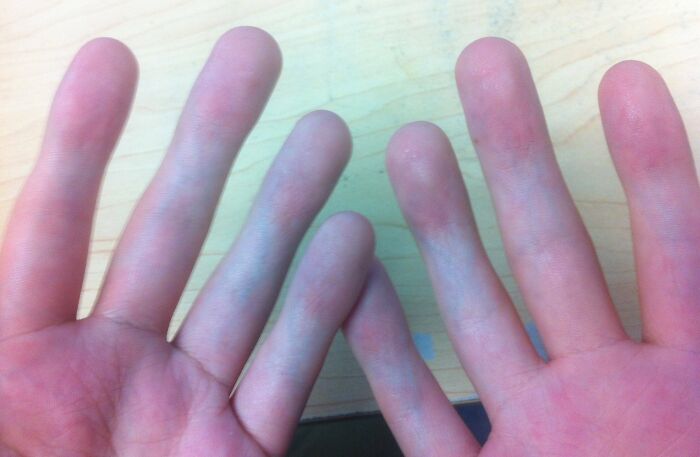 I Cannot Bend Any Of My Fingers So There Have Never Been Any Wrinkles