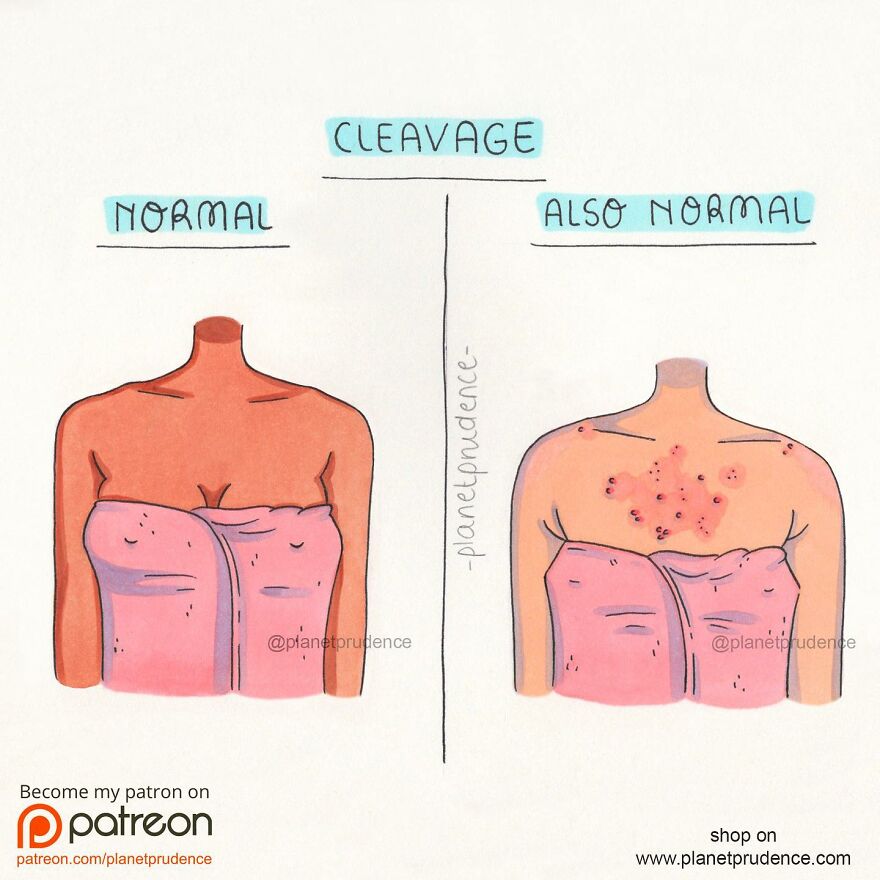 Relatable Comics That Beautifully Depicts Girl’s Everyday Problems (New Pics)