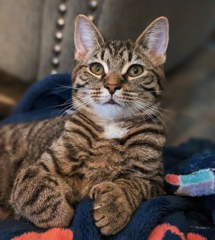 Amber With Her Extra Toes