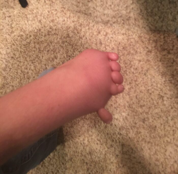 This Is My Left Hand, I Was Born With It And I Can Still Do Plenty Of Stuff