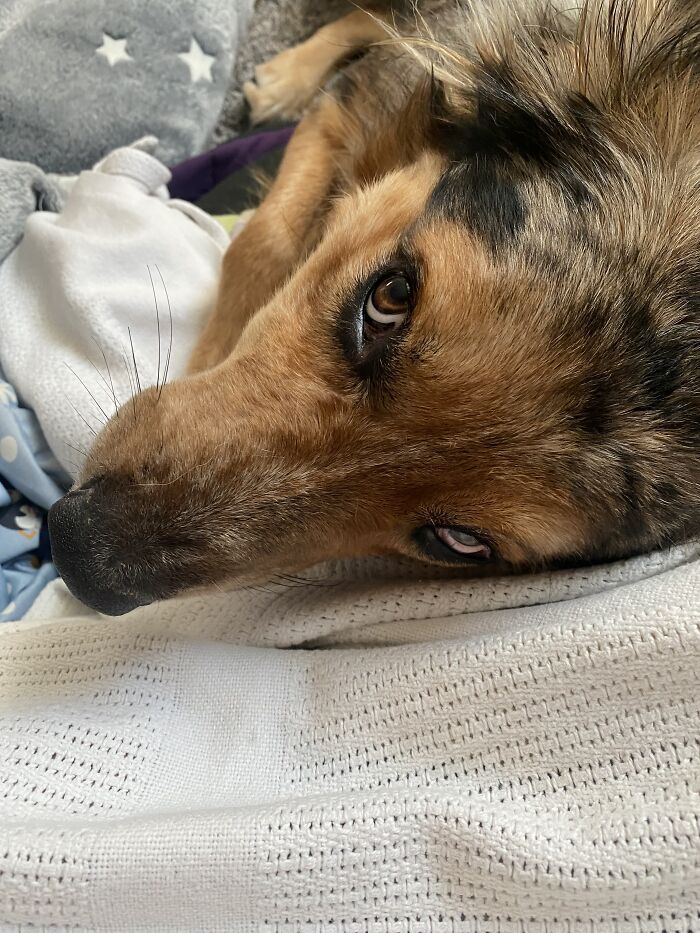 Taco Worrying About My Broken Wrist