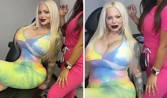 Lo que publicó ella VS lo que publicó la clínica