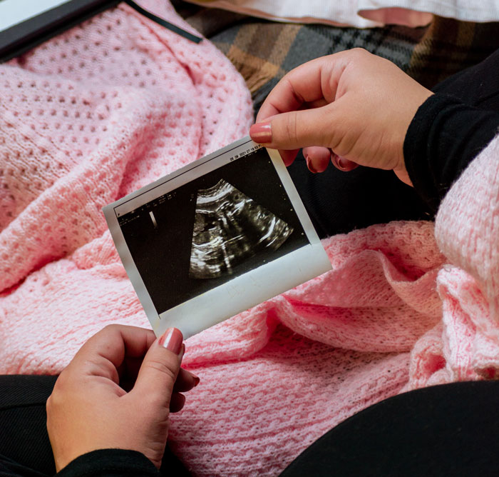 30 Cases Of Women Being Ignorant About A Baby Growing Inside Of Them, As Shared Online