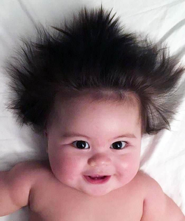 For Those Of You Who Said Her Hair Would Fall Out When Her Picture Went Viral 4 Months Ago. This Isn't Even Her Final Form