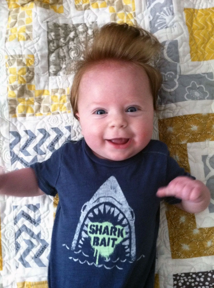 My Friend's Baby Was Also Born With Conan Hair