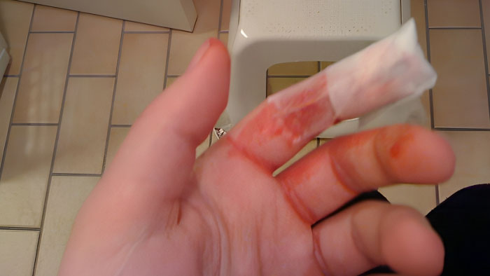 30 People Share The Wildest Things They've Witnessed While Waiting To Be Treated By The ER