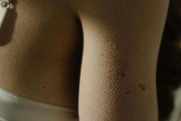 Close-up of skin with goosebumps illustrating creepy facts about the world and unusual human body reactions.