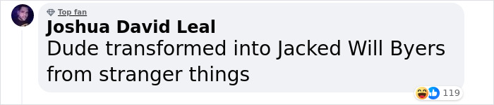 Zac Efron Surprises Fans With Physical Transformation Following Domestic Accident