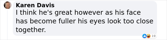 Zac Efron Surprises Fans With Physical Transformation Following Domestic Accident