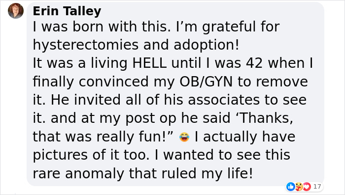 Woman With Double Uterus Is Expecting A Baby In Both, Twin Daughters Could Be Born Weeks Apart Woman With Double Uterus Is Expecting A Baby In Both, Twin Daughters Could Be Born Weeks Apart