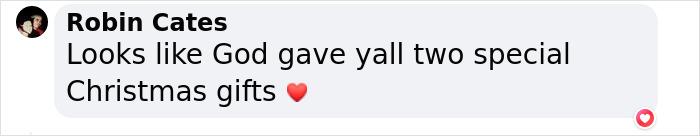 Woman With Double Uterus Is Expecting A Baby In Both, Twin Daughters Could Be Born Weeks Apart Woman With Double Uterus Is Expecting A Baby In Both, Twin Daughters Could Be Born Weeks Apart