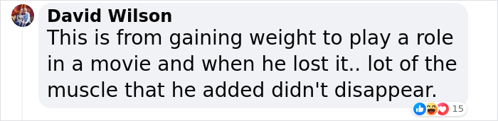 Zac Efron Surprises Fans With Physical Transformation Following Domestic Accident