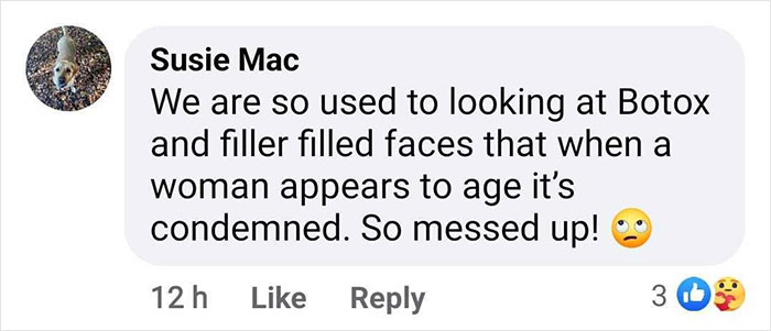 &ldquo;This Is What Women Look Like&rdquo;: People Defend Kate Middleton Against &ldquo;Ageist&rdquo; Trolls