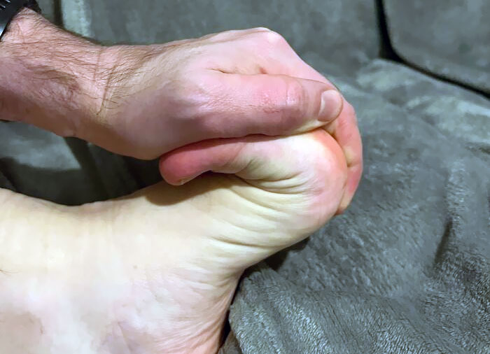 I Can Bend My Toes Back To My Foot