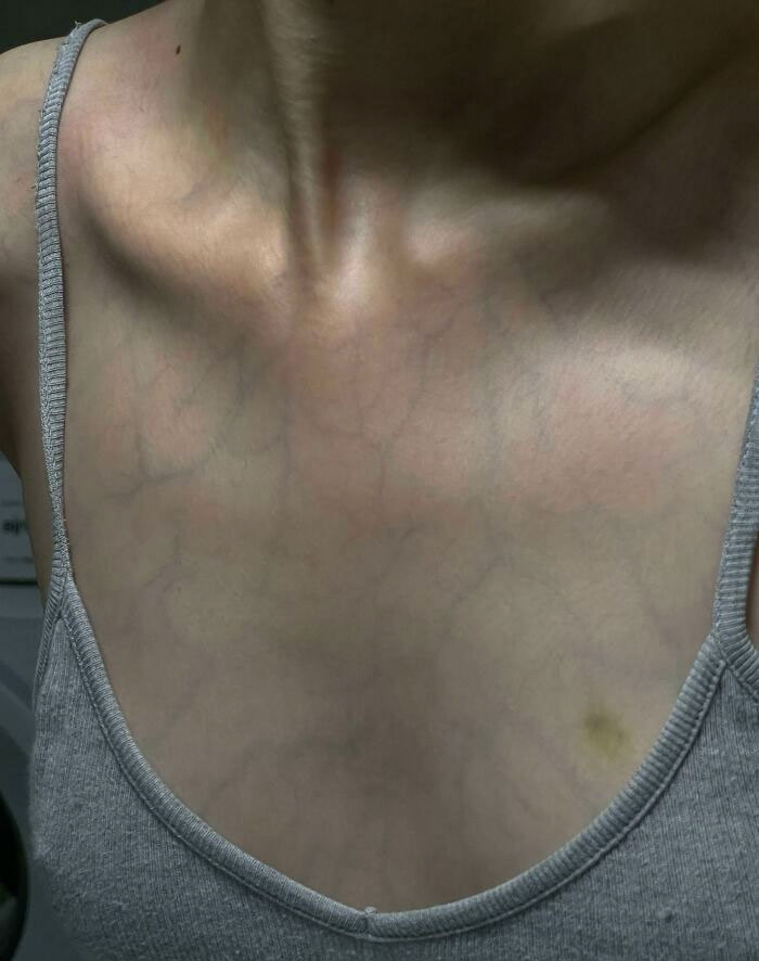 My Skin Is Translucent