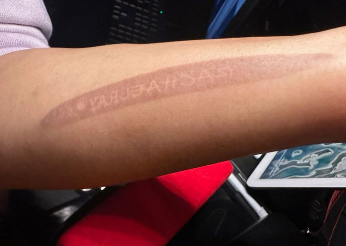 I Accidently Branded Rachael Ray's Name On Myself With One Of Her Roasting Trays