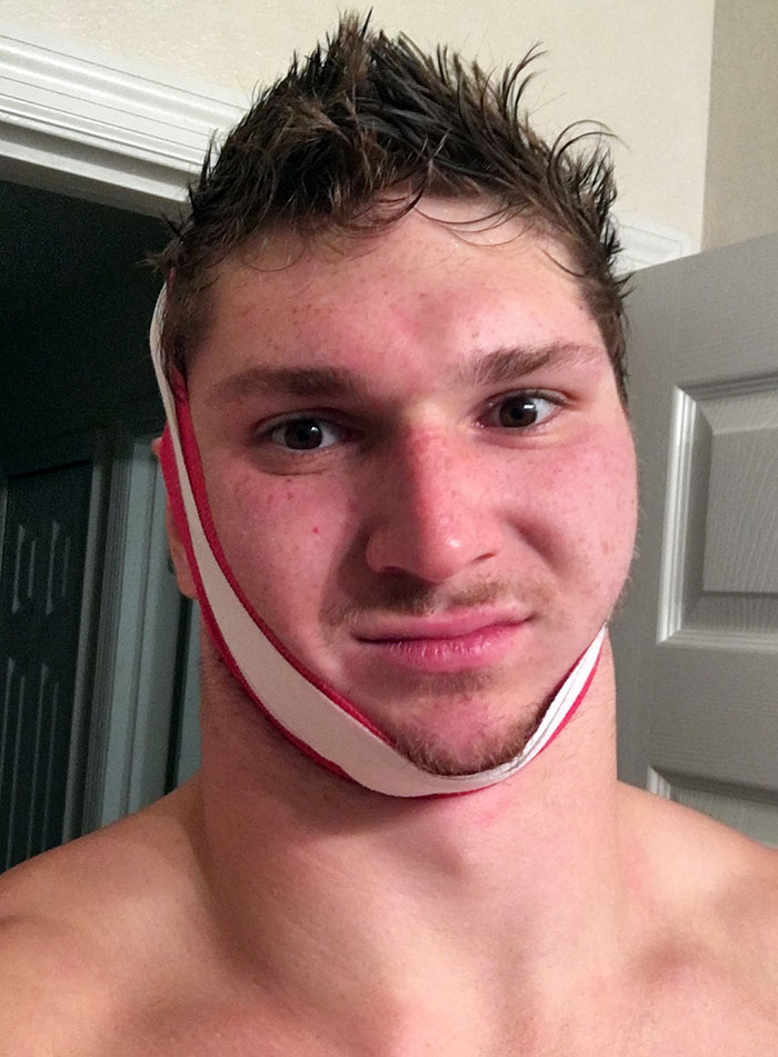 I Started Off My Thanksgiving By Having A 5-Pound Weight Fall On My Head. I Hope Yours Is Better Than Mine. But, Hey, I'm Thankful My Family's Always There To Bandage Me Up