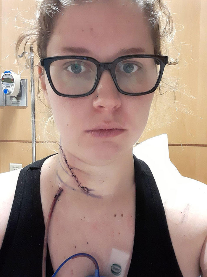 Thankful This Thanksgiving To Be Tumor Free