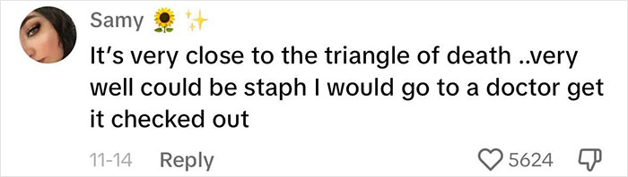 Fans Urge Brooke Hyland To Seek Medical Care After Showing Her “Triangle Of Death” Pimple Fans Urge Brooke Hyland To Seek Medical Care After Showing Her “Triangle Of Death” Pimple