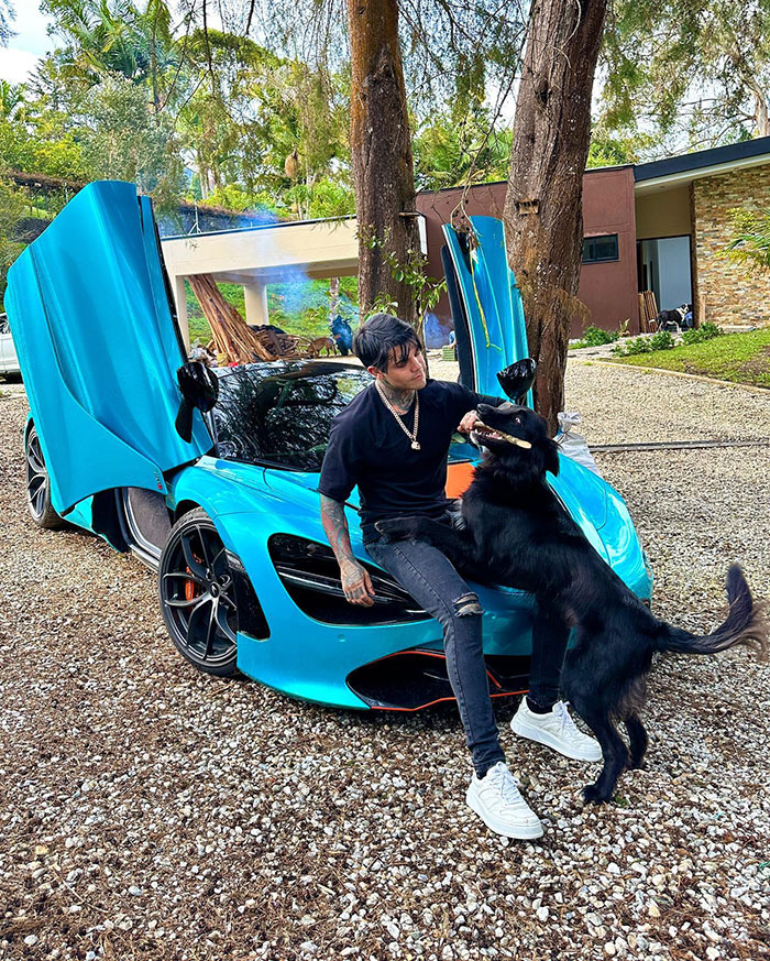 Influencer Spends $175,000 On &ldquo;Most Painful&rdquo; Leg-Lengthening Surgery To Grow Six Inches