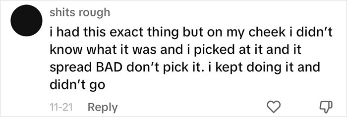 Fans Urge Brooke Hyland To Seek Medical Care After Showing Her “Triangle Of Death” Pimple Fans Urge Brooke Hyland To Seek Medical Care After Showing Her “Triangle Of Death” Pimple