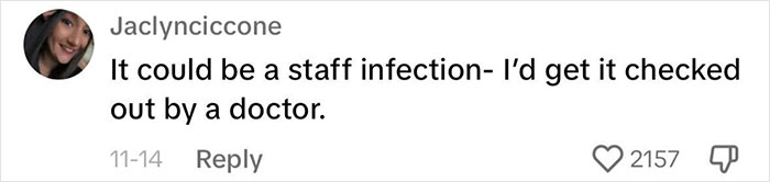 Fans Urge Brooke Hyland To Seek Medical Care After Showing Her “Triangle Of Death” Pimple Fans Urge Brooke Hyland To Seek Medical Care After Showing Her “Triangle Of Death” Pimple