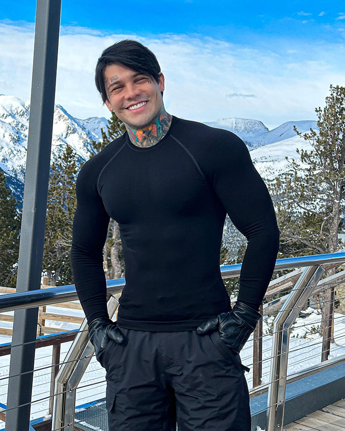 Influencer Spends $175,000 On &ldquo;Most Painful&rdquo; Leg-Lengthening Surgery To Grow Six Inches