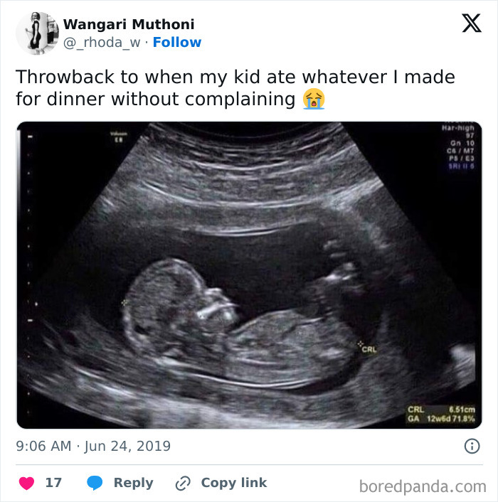 Ultrasound image with humorous parenting meme text about a child's eating habits.