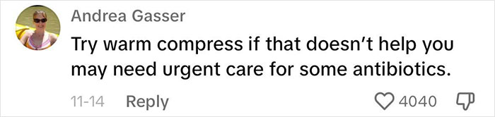 Fans Urge Brooke Hyland To Seek Medical Care After Showing Her “Triangle Of Death” Pimple Fans Urge Brooke Hyland To Seek Medical Care After Showing Her “Triangle Of Death” Pimple