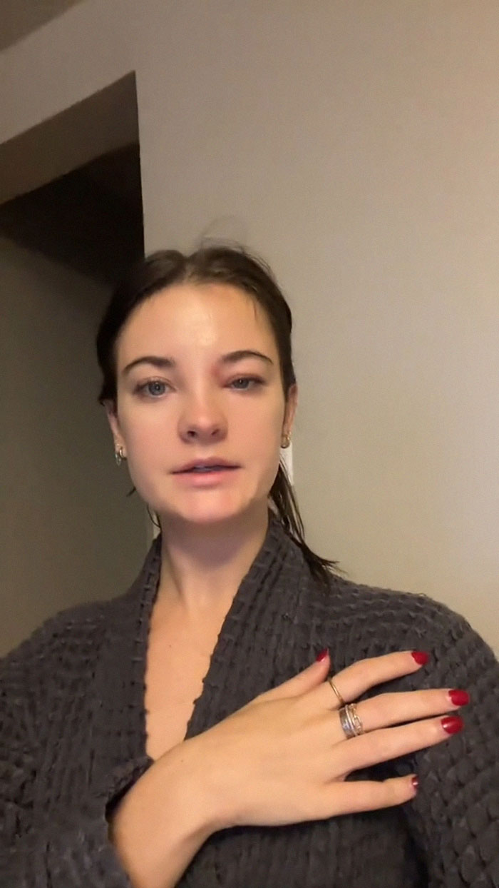 Fans Urge Brooke Hyland To Seek Medical Care After Showing Her “Triangle Of Death” Pimple Fans Urge Brooke Hyland To Seek Medical Care After Showing Her “Triangle Of Death” Pimple