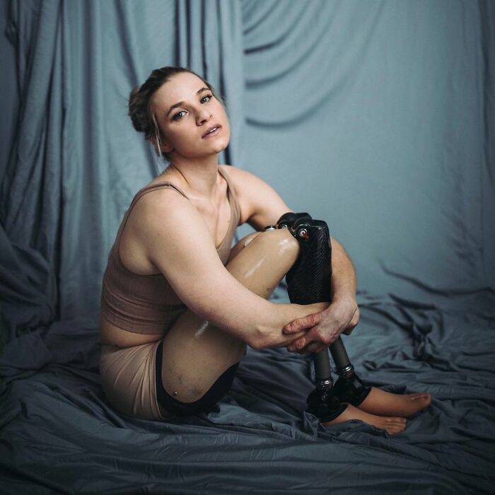 Woman Adopts Abandoned Disabled Child, Nurtures Her Into A World-Class Athlete