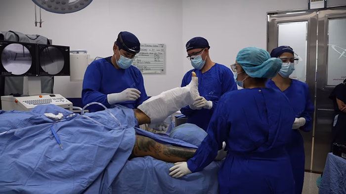 Influencer Spends $175,000 On &ldquo;Most Painful&rdquo; Leg-Lengthening Surgery To Grow Six Inches