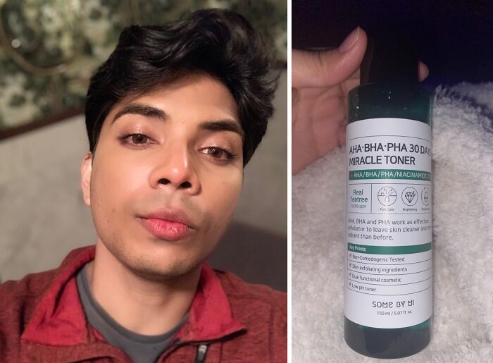 Gentle Exfoliating Genius: Get Ready For The Aha Bha Pha 30 Days Miracle Toner - It's A Skincare Revolution That's Truly Miraculous!