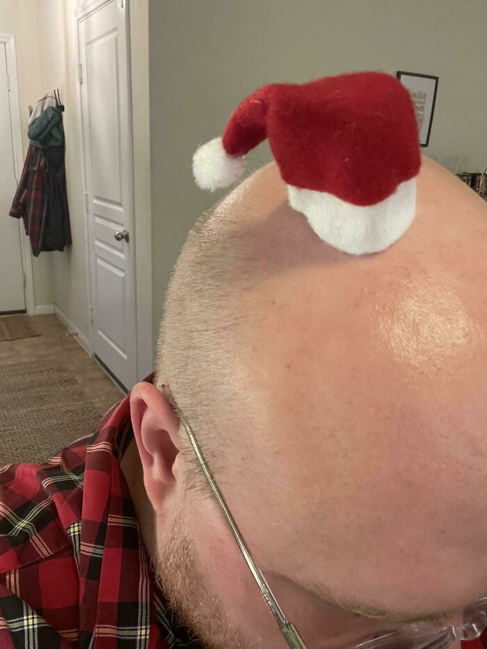 I’m The Talk Of Every Christmas Party, Thanks To This Little Hat. How Do You Think It Stays In Place?