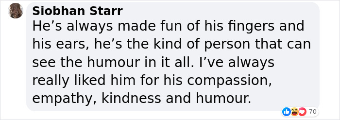 &ldquo;Glad He Has A Sense Of Humor&rdquo;: King Charles Roasts His Own Fingers In New BBC Documentary