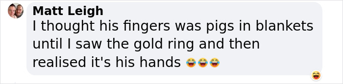 &ldquo;Glad He Has A Sense Of Humor&rdquo;: King Charles Roasts His Own Fingers In New BBC Documentary