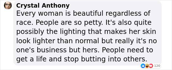 Beyonc&eacute; Stuns Fans With Close-Up Shot Amid Criticism For &ldquo;Going White&rdquo;