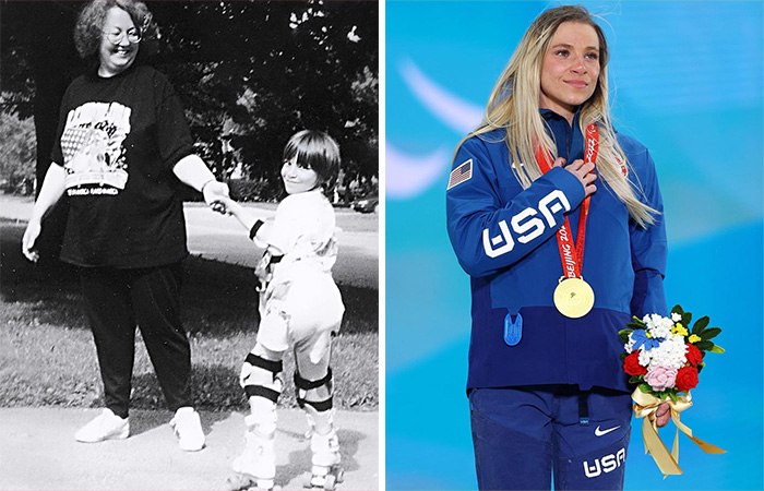 Woman Adopts Abandoned Disabled Child, Nurtures Her Into A World-Class Athlete