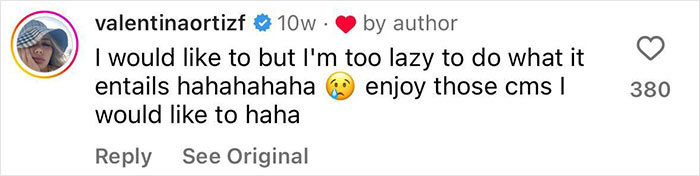 Influencer Spends $175,000 On &ldquo;Most Painful&rdquo; Leg-Lengthening Surgery To Grow Six Inches