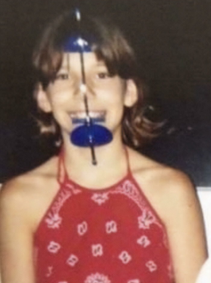 I Had To Wear This Bad Boi Throughout Grade Five. I Had To Develop A Personality Fast