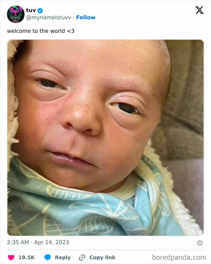 This Baby Looks Like Miggy Almiron In About 40 Years. Oldest Looking Newborn I've Seen In My Life