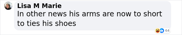 Influencer Spends $175,000 On &ldquo;Most Painful&rdquo; Leg-Lengthening Surgery To Grow Six Inches