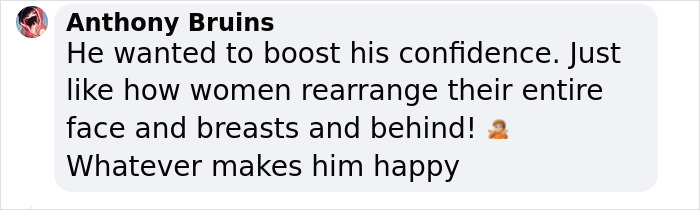 Influencer Spends $175,000 On &ldquo;Most Painful&rdquo; Leg-Lengthening Surgery To Grow Six Inches