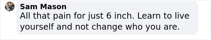 Influencer Spends $175,000 On &ldquo;Most Painful&rdquo; Leg-Lengthening Surgery To Grow Six Inches