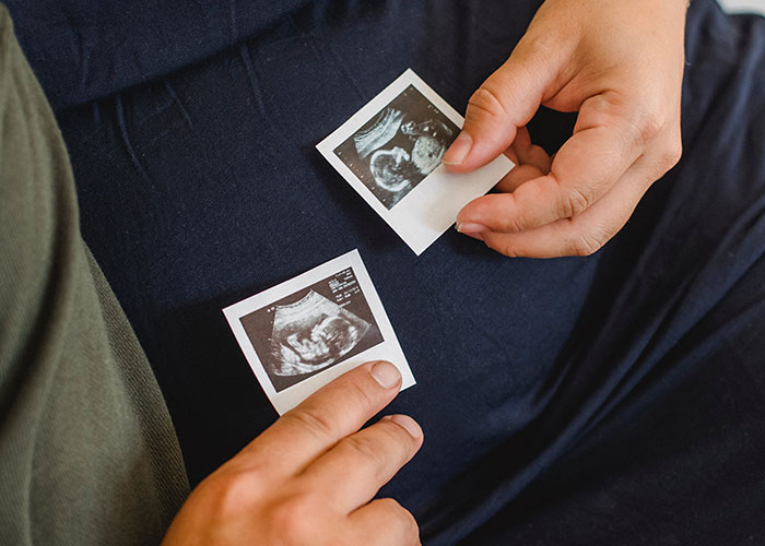 "Your Nose Grows": 30 Women Share Pregnancy Side Effects They Had No Idea About